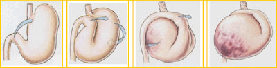 disegno torsione